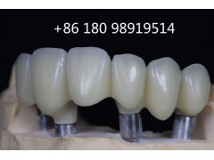 專業(yè)牙科診所義齒供應(yīng)商Myy國際代理合作